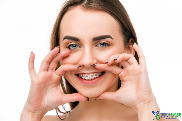The price of upper jaw Expansion
